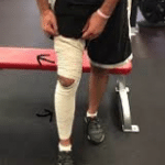 hurt-knee-still-need-to-workout