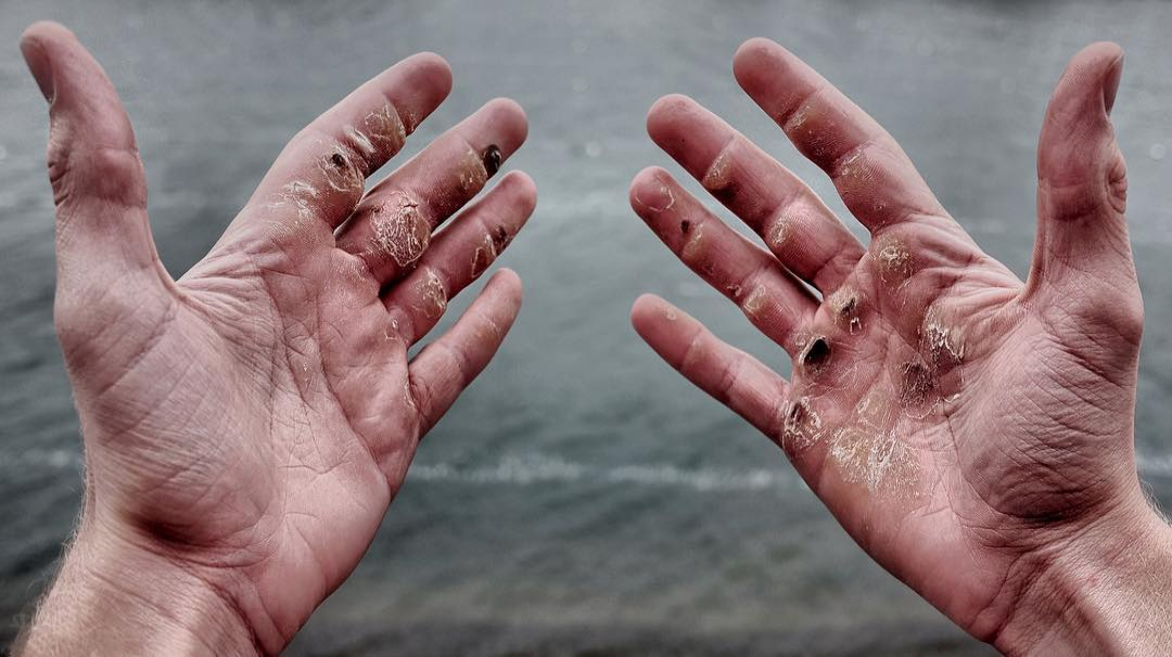 Featured image for “Hand Care Tips for Functional Fitness + CrossFit Athletes”